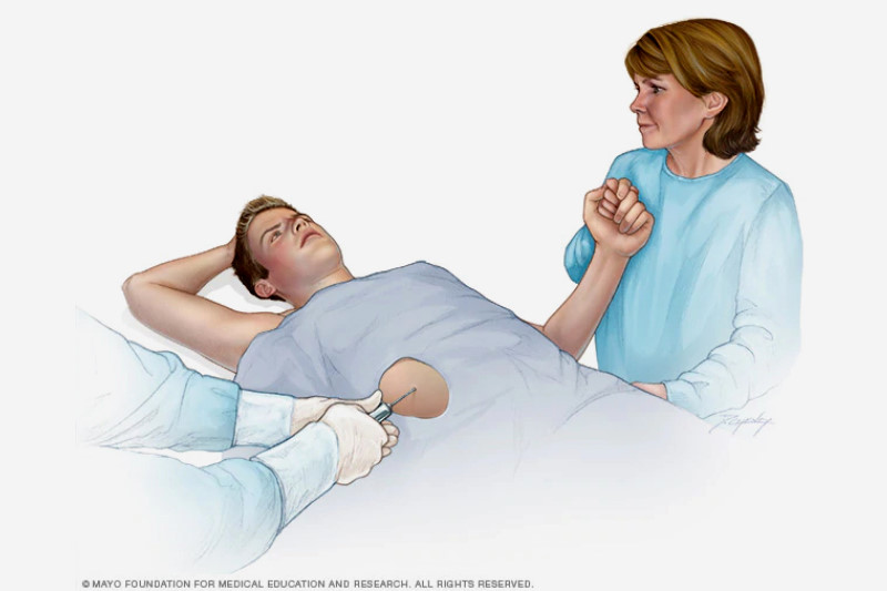 Liver Biopsy Gastrocare Hospital liver-biopsy-gastrocare-hospital